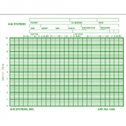 Spire Chart